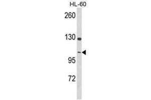 Western blot analysis of Dynamin 3 Antibody (Center) in HL-60 cell line lysates (35ug/lane).