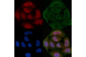 ABIN6260720 and ABIN6276822 staining Hela cells by IF/ICC. (CDK7 anticorps  (Internal Region))