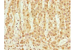 Immunohistochemistry of paraffin-embedded human adrenal gland tissue using ABIN7173131 at dilution of 1:100