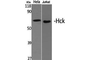 Western Blotting (WB) image for anti-Hemopoietic Cell Kinase (HCK) (Ser468) antibody (ABIN3184982)
