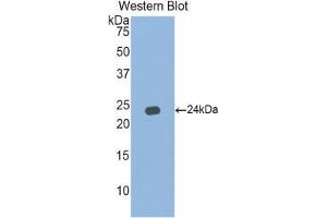 Western Blotting (WB) image for anti-Interferon, alpha 5 (IFNA5) (AA 24-189) antibody (ABIN3203132) (IFNA5 anticorps  (AA 24-189))