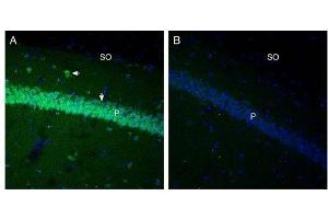 Expression of GPR91 in mouse hippocampus. (SUCNR1 anticorps  (Extracellular))