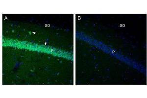 Expression of GPR91 in mouse hippocampus. (SUCNR1 anticorps  (3rd Extracellular Loop))