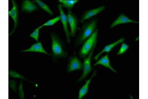 Immunofluorescence staining of Hela cells with ABIN7156276 at 1:66, counter-stained with DAPI. (Pyrophosphatase (Inorganic) 1 (PPA1) (AA 59-173) anticorps)