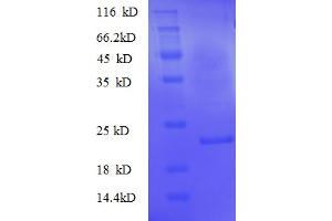 SDS-PAGE (SDS) image for Tumor Protein, Translationally-Controlled 1 (TPT1) (AA 1-172), (full length) protein (His tag) (ABIN5710544)