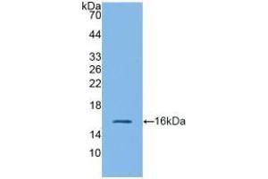 Detection of Recombinant GLP1R, Mouse using Polyclonal Antibody to Glucagon Like Peptide 1 Receptor (GLP1R)