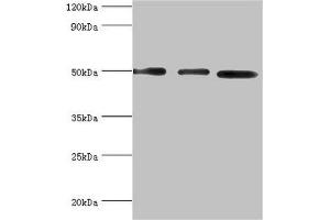 Western blot All lanes: Adenylosuccinate synthetase isozyme 2 antibody at 12 μg/mL Lane 1: Mouse skeletal muscle tissue Lane 2: HepG2 whole cell lysate Lane 3: K562 whole cell lysate Secondary Goat polyclonal to rabbit IgG at 1/10000 dilution Predicted band size: 50 kDa Observed band size: 50 kDa (ADSS anticorps  (AA 1-280))