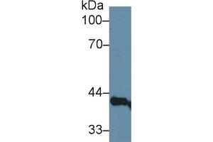 Western Blot; Sample: Rat Serum; Primary Ab: 1µg/ml Rabbit Anti-Rat LEDGF Antibody Second Ab: 0. (PSIP1 anticorps  (AA 311-469))