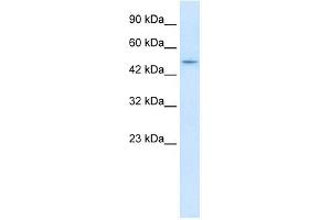 Western Blot showing ZNF651 antibody used at a concentration of 1-2 ug/ml to detect its target protein. (ZBTB47 anticorps  (N-Term))