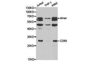 Western Blotting (WB) image for anti-CD69 (CD69) antibody (ABIN1871647) (CD69 anticorps)