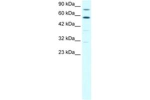 Western Blotting (WB) image for anti-Staphylococcal Nuclease Domain Containing Protein 1 (SND1) antibody (ABIN2460503) (SND1 anticorps)