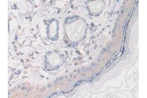 Detection of SERPINA10 in Rat Skin Tissue using Polyclonal Antibody to Serpin A10 (SERPINA10)