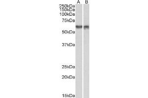 ABIN2564428 (1µg/ml) staining of nuclear NIH3T3 (A) and nuclear HeLa (B) lysates (35µg protein in RIPA buffer). (PDCD4 anticorps  (Internal Region))