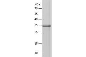 Western Blotting (WB) image for Fibroblast Growth Factor Receptor 3 (FGFR3) (AA 23-320) protein (His tag) (ABIN7122956) (FGFR3 Protein (AA 23-320) (His tag))