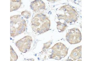 Immunohistochemistry of paraffin-embedded Human stomach using CLUH Polyclonal Antibody at dilution of 1:100 (40x lens). (CLUH anticorps)