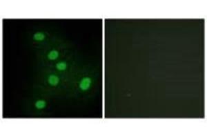 Immunofluorescence analysis of HepG2 cells, using NR2F6 antibody. (NR2F6 anticorps  (N-Term))