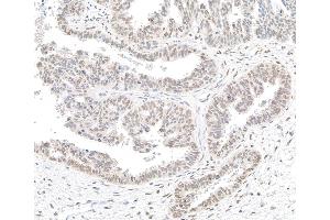 anti-BCL2-Associated Transcription Factor 1 (BCLAF1) (AA 150-200) antibody