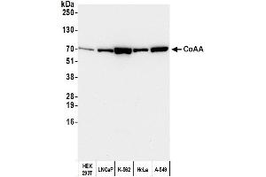 Western Blotting (WB) image for anti-CoaA (AA 550-600) antibody (ABIN7451577) (CoaA (AA 550-600) anticorps)