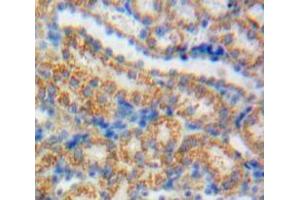 IHC-P analysis of Kidney tissue, with DAB staining. (GDNF anticorps  (AA 78-211))