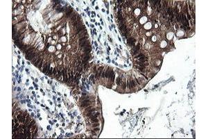 Image no. 9 for anti-Cytidine Monophosphate (UMP-CMP) Kinase 1, Cytosolic (CMPK1) antibody (ABIN1497542)