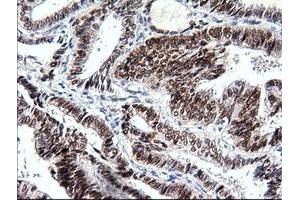 Image no. 3 for anti-SRY (Sex Determining Region Y)-Box 17 (SOX17) (AA 177-414) antibody (ABIN1491032)