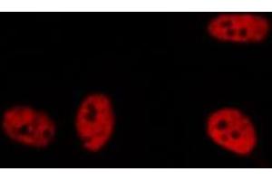 ABIN6276435 staining  HuvEc cells by IF/ICC. (MSH6 anticorps  (Internal Region))