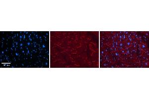 Rabbit Anti-KEAP1 Antibody    Formalin Fixed Paraffin Embedded Tissue: Human Adult heart  Observed Staining: Cytoplasmic (within intercalated disks) Primary Antibody Concentration: 1:600 Secondary Antibody: Donkey anti-Rabbit-Cy2/3 Secondary Antibody Concentration: 1:200 Magnification: 20X Exposure Time: 0. (KEAP1 anticorps  (C-Term))