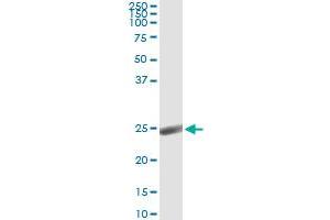 Immunoprecipitation of ORM1 transfected lysate using anti-ORM1 monoclonal antibody and Protein A Magnetic Bead , and immunoblotted with ORM1 MaxPab rabbit polyclonal antibody.
