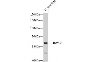 Western blot analysis of extracts of Mouse liver using PRDM14 Polyclonal Antibody at dilution of 1:1000. (PRDM14 anticorps)