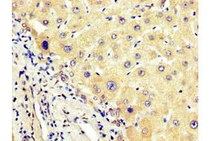 IHC image of ABIN7144136 diluted at 1:400 and staining in paraffin-embedded human liver tissue performed on a Leica BondTM system.