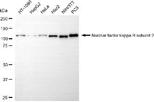 anti-Nuclear Factor kappa B (NFkB) (Subunit 2) antibody