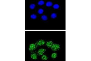 Confocal immunofluorescent analysis with Hela cells using MSH2 Antibody , followed by Alexa Fluor® 488-conjugated goat anti-rabbit lgG (green).