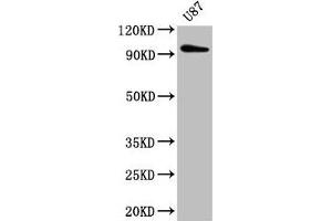 Western Blot Positive WB detected in: U87 whole cell lysate All lanes: TTLL6 antibody at 5 μg/mL Secondary Goat polyclonal to rabbit IgG at 1/50000 dilution Predicted band size: 97, 65 kDa Observed band size: 97 kDa (TTLL6 anticorps  (AA 121-310))