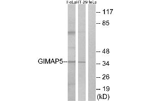 Immunohistochemistry analysis of paraffin-embedded human placenta tissue using GIMAP5 antibody.