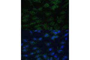 anti-Eukaryotic Translation Initiation Factor 1A, X-Linked (EIF1AX) (AA 10-144) antibody