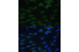 Immunofluorescence analysis of C6 cells using EIF1AX Polyclonal Antibody (ABIN6131999, ABIN6140017, ABIN6140018 and ABIN6221620) at dilution of 1:100 (40x lens). (EIF1AX anticorps  (AA 10-144))