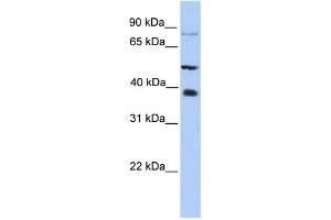 METTL2B antibody used at 1 ug/ml to detect target protein. (METTL2B anticorps  (N-Term))
