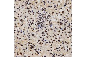 Immunohistochemistry of paraffin-embedded mouse liver fibrosis using PELP1 antibody (ABIN6292223) at dilution of 1:200 (40x lens). (PELP1 anticorps)