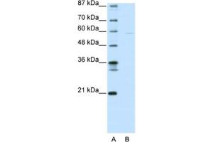 Western Blotting (WB) image for anti-SWI/SNF Related, Matrix Associated, Actin Dependent Regulator of Chromatin, Subfamily D, Member 3 (SMARCD3) antibody (ABIN2461185) (SMARCD3 anticorps)