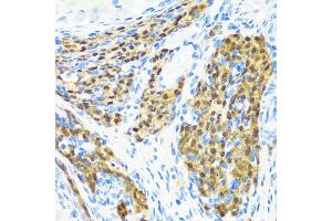 Immunohistochemistry of paraffin-embedded rat ovary using KMT2E antibody (ABIN6131786, ABIN6142983, ABIN6142984 and ABIN6221745) at dilution of 1:200 (40x lens). (MLL5/KMT2E anticorps  (AA 200-500))