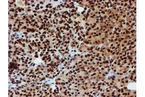 Image no. 3 for anti-Peptidyl Arginine Deiminase, Type IV (PADI4) antibody (ABIN1500017)