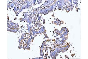 IHC analysis of Collagen VI/COL6A2 using anti-Collagen VI/COL6A2 antibody (ABIN7601439).