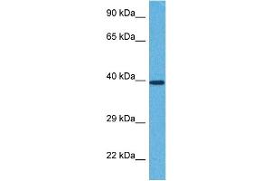 Host:  Rabbit  Target Name:  ST3GAL4  Sample Tissue:  Human 786-0 Whole Cell  Antibody Dilution:  1ug/ml (ST3GAL4 anticorps  (Middle Region))