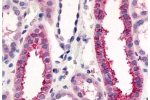 Immunohistochemistry (Formalin/PFA-fixed paraffin-embedded sections) of human kidney, renal tubules with VN1R1 polyclonal antibody . (VN1R1 anticorps  (C-Term))