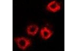 Immunofluorescent analysis of HADHB staining in A549 cells. (HADHB anticorps)
