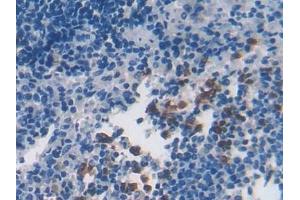 Detection of CYGB in Rat Spleen Tissue using Polyclonal Antibody to Cytoglobin (CYGB)