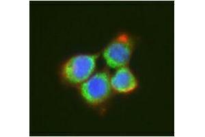 Immunofluorescence (IF) image for anti-DEAD (Asp-Glu-Ala-Asp) Box Polypeptide 6 (DDX6) antibody (ABIN2664929)