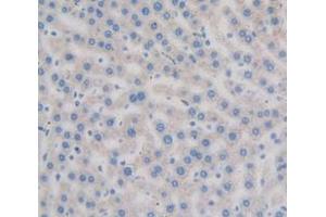 Used in DAB staining on fromalin fixed paraffin- embedded Kidney tissue (Axin anticorps  (AA 618-827))