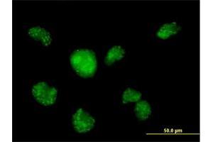 Immunofluorescence of purified MaxPab antibody to CALML3 on HeLa cell. (CALML3 anticorps  (AA 1-149))