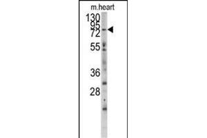 Western blot analysis of anti-MYLK3 Antibody (N-term) (ABIN392494 and ABIN2837985) in mouse heart tissue lysates (35 μg/lane).